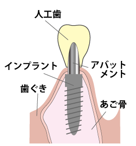 �C���v�����g�̍\��