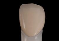 �n�C�u���b�h