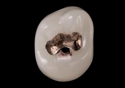 �ی��̃C�����[