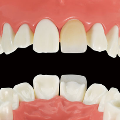 ���~�l�[�g�x�j�A